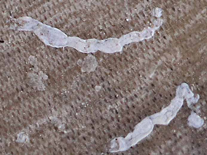 Foraminiferes Nubeculinella ? fossiles Boulonnais